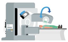 PET-scan voor longkanker